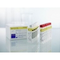 Холестерин ЛПВП 125 мл HDL-C Immuno FS Diasys ( 1 3521 99 10 021 ) Холестерин ЛПВП 125 мл HDL-C Immuno FS Diasys ( 1 3521 99 10 021 )